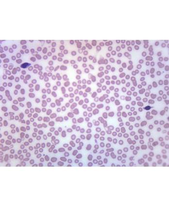 Human Blood Smear WR Stain - Prepared Microscope Slide