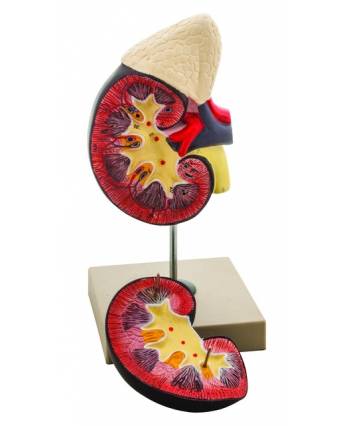 Life-Size Human Kidney with Adrenal Gland Model