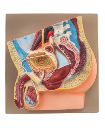 Male Vasectomy
