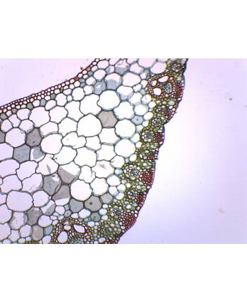 Monocot & Dicot Leaf - Prepared Microscope Slide
