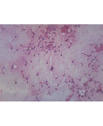 Human Sperm Smear - Prepared Microscope Slide